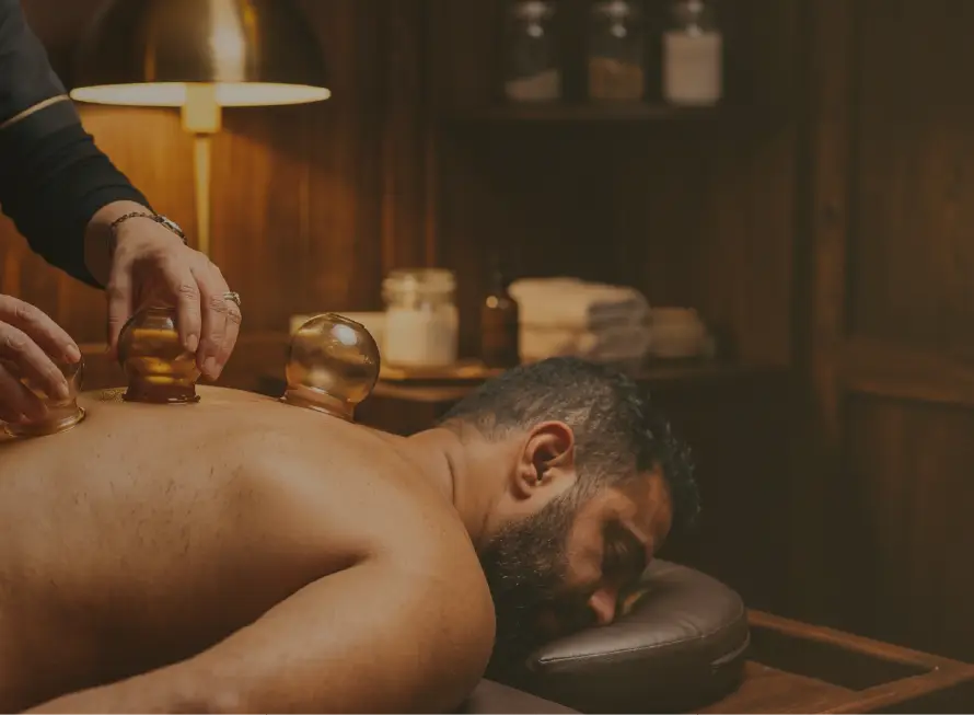 cupping therapy